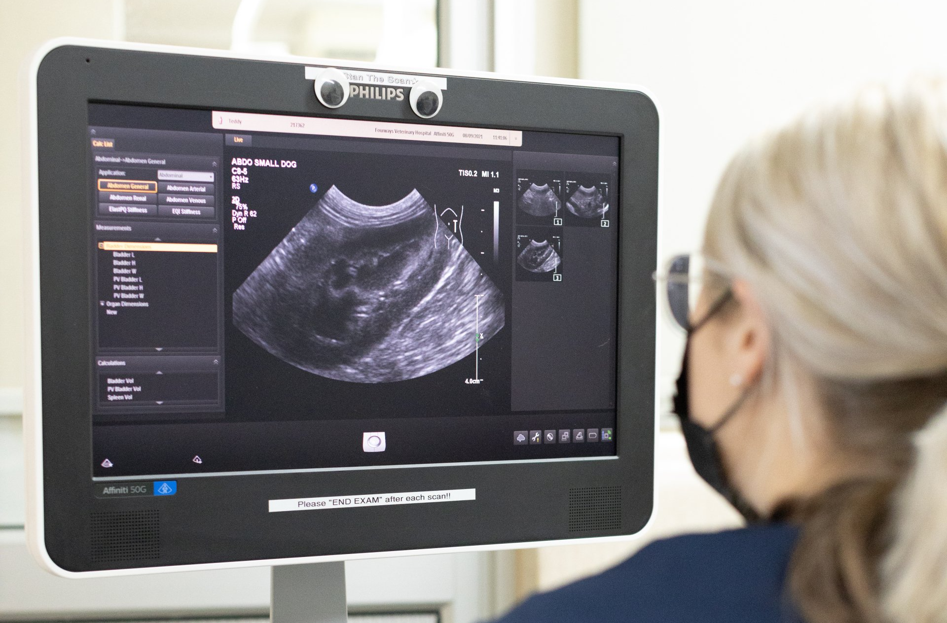 Ultrasound Equipment