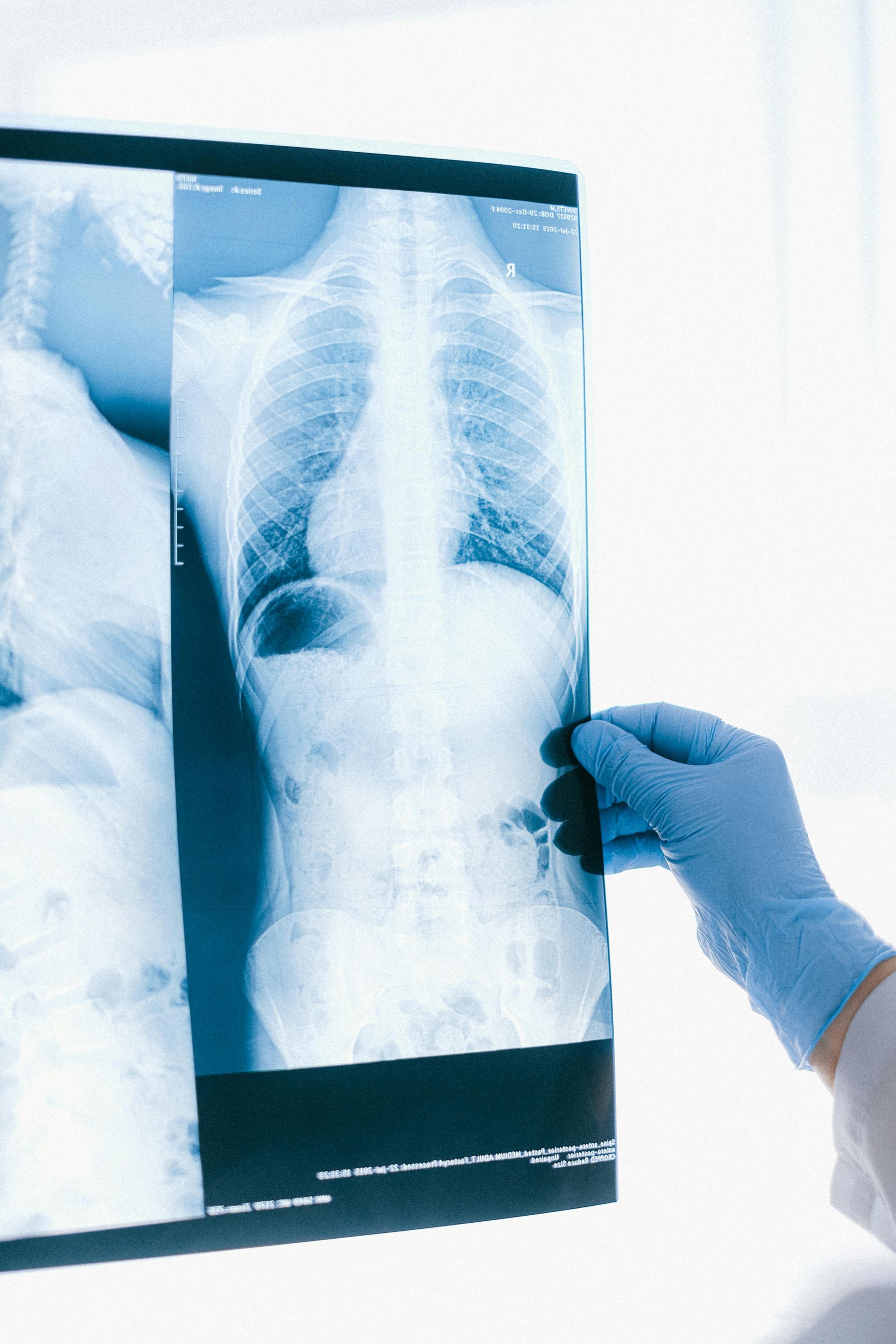 What is MRI Imaging?