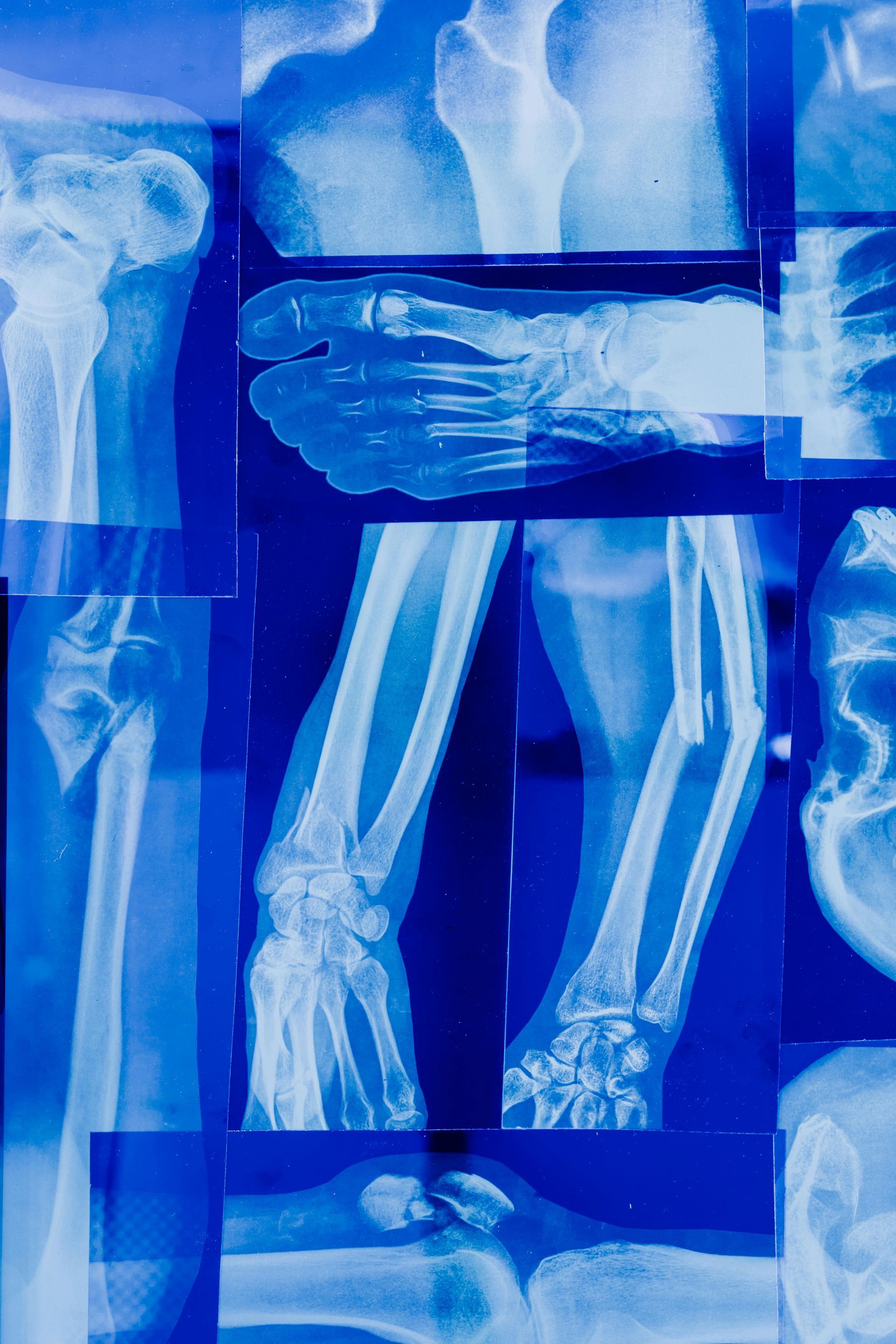 What is C-Arm Imaging?